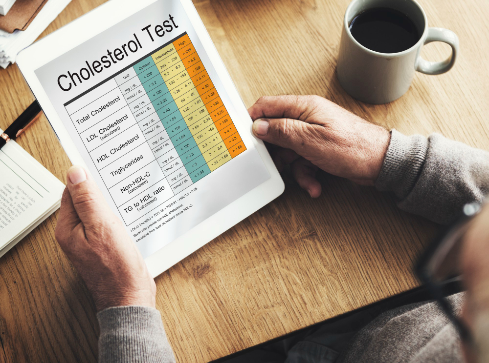 Signs of High Cholesterol Many People Ignore Until a Health Checkup | Prinz Klinik